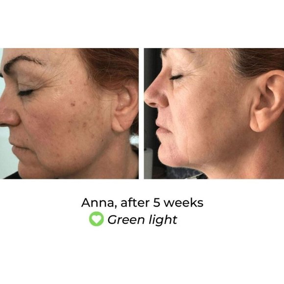 NIB Predire Paris 8 Element Treatment Led Mask - Picture 3 of 15